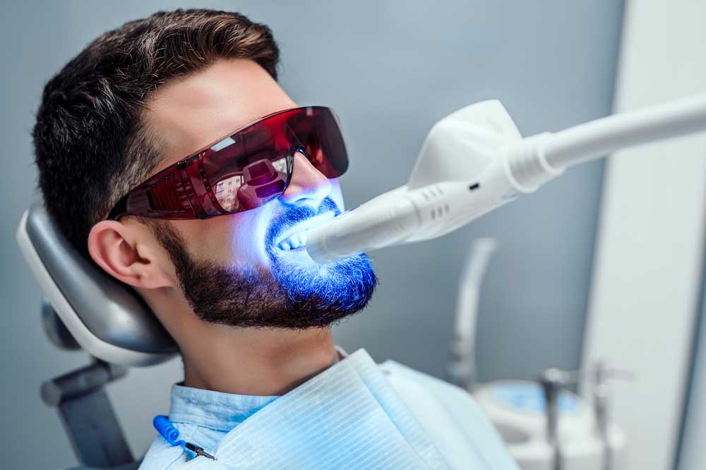 Sbiancamento dei denti dopo l’igiene orale