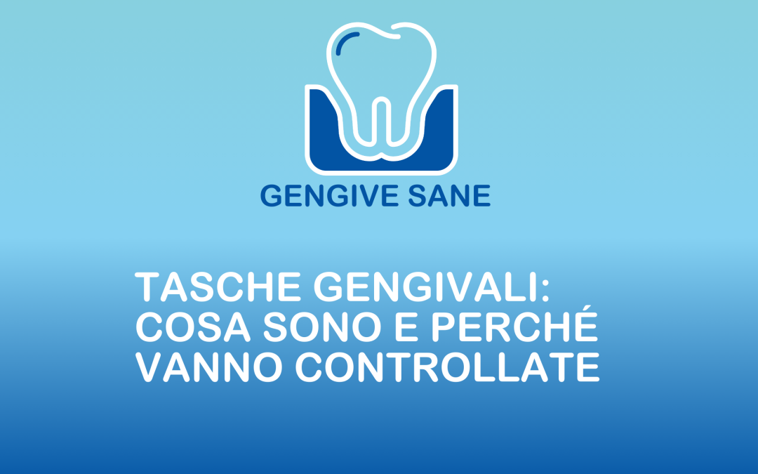 Tasche gengivali: cosa sono e perché vanno controllate