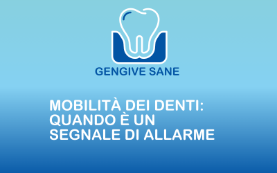Mobilità dei denti: quando è un segnale di allarme