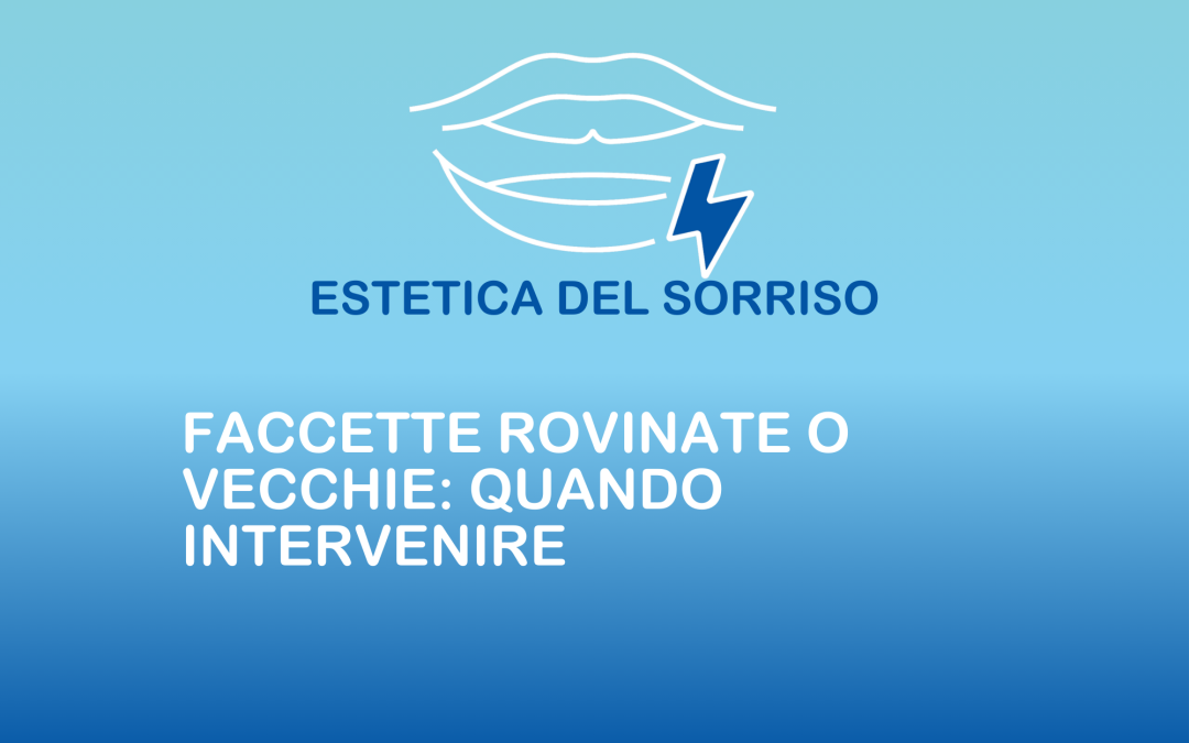 Faccette rovinate o vecchie: quando intervenire