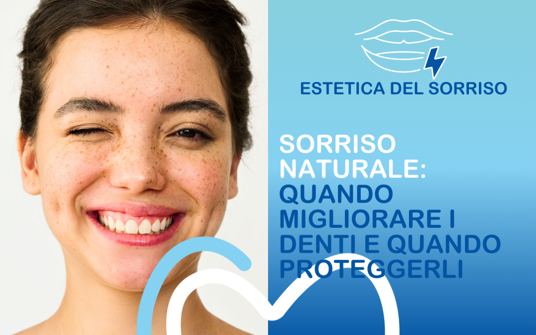 Sorriso naturale: quando migliorare i denti e quando proteggere ciò che c’è