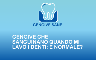 Gengive che sanguinano quando mi lavo i denti: è normale?