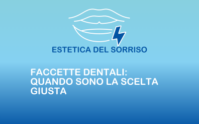 Faccette dentali: quando sono la scelta giusta