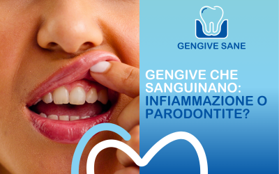 Gengive che sanguinano: quando è solo infiammazione e quando è parodontite