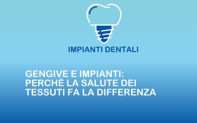 Gengive e impianti: perché la salute dei tessuti fa la differenza