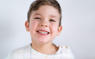 Dentizione nei bambini: cosa aspettarsi e quando intervenire